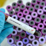 Blood sample with respiratory coronavirus positive