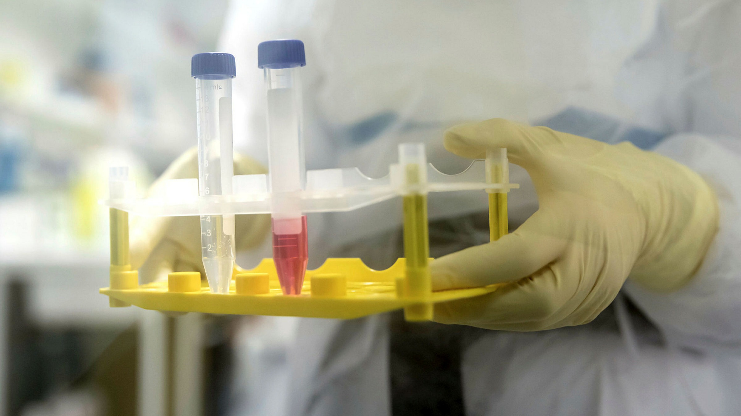 Biotech company on a rush to develop COVID-19 vaccine from tobacco plants